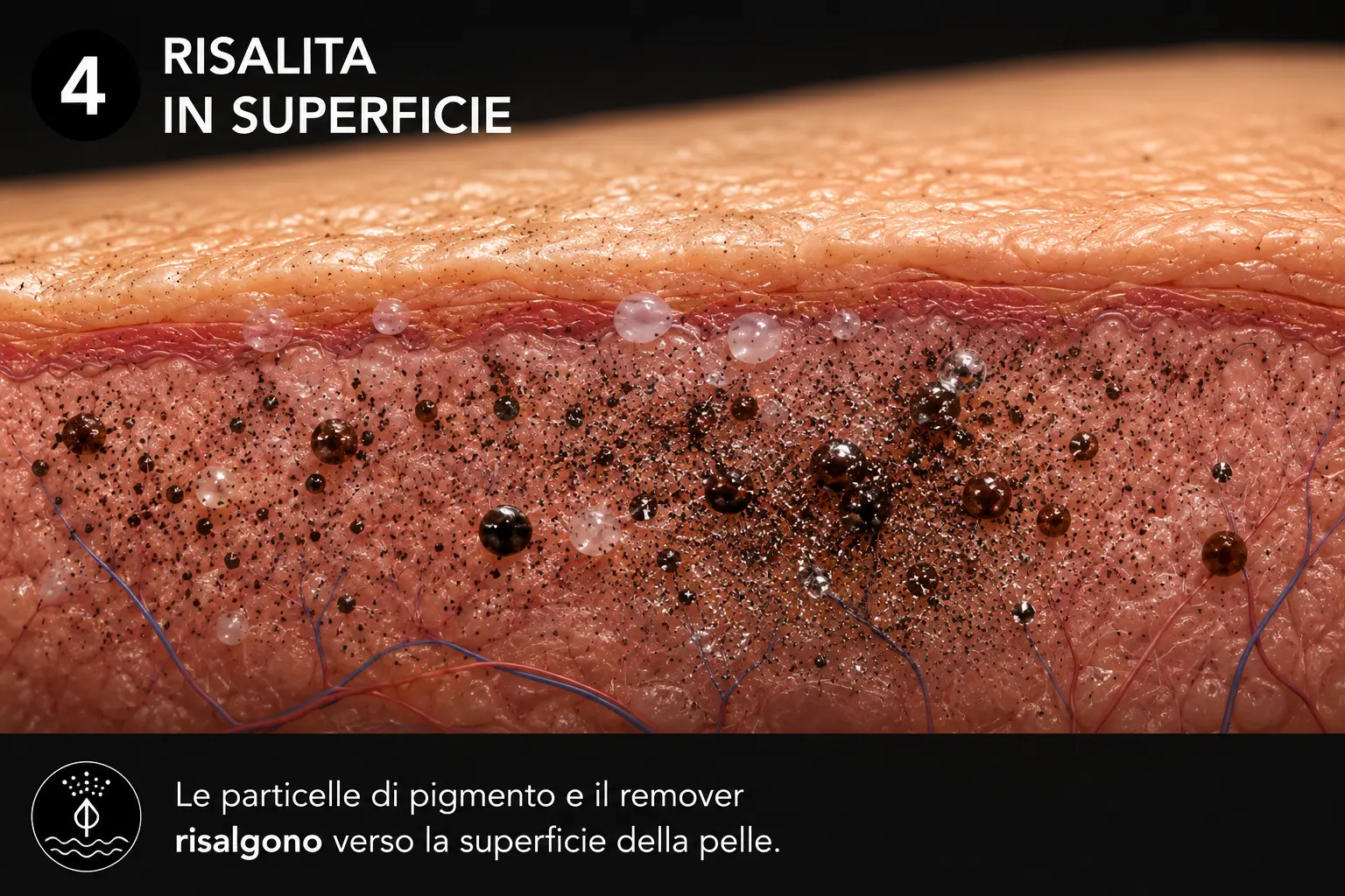 Risalita in superficie