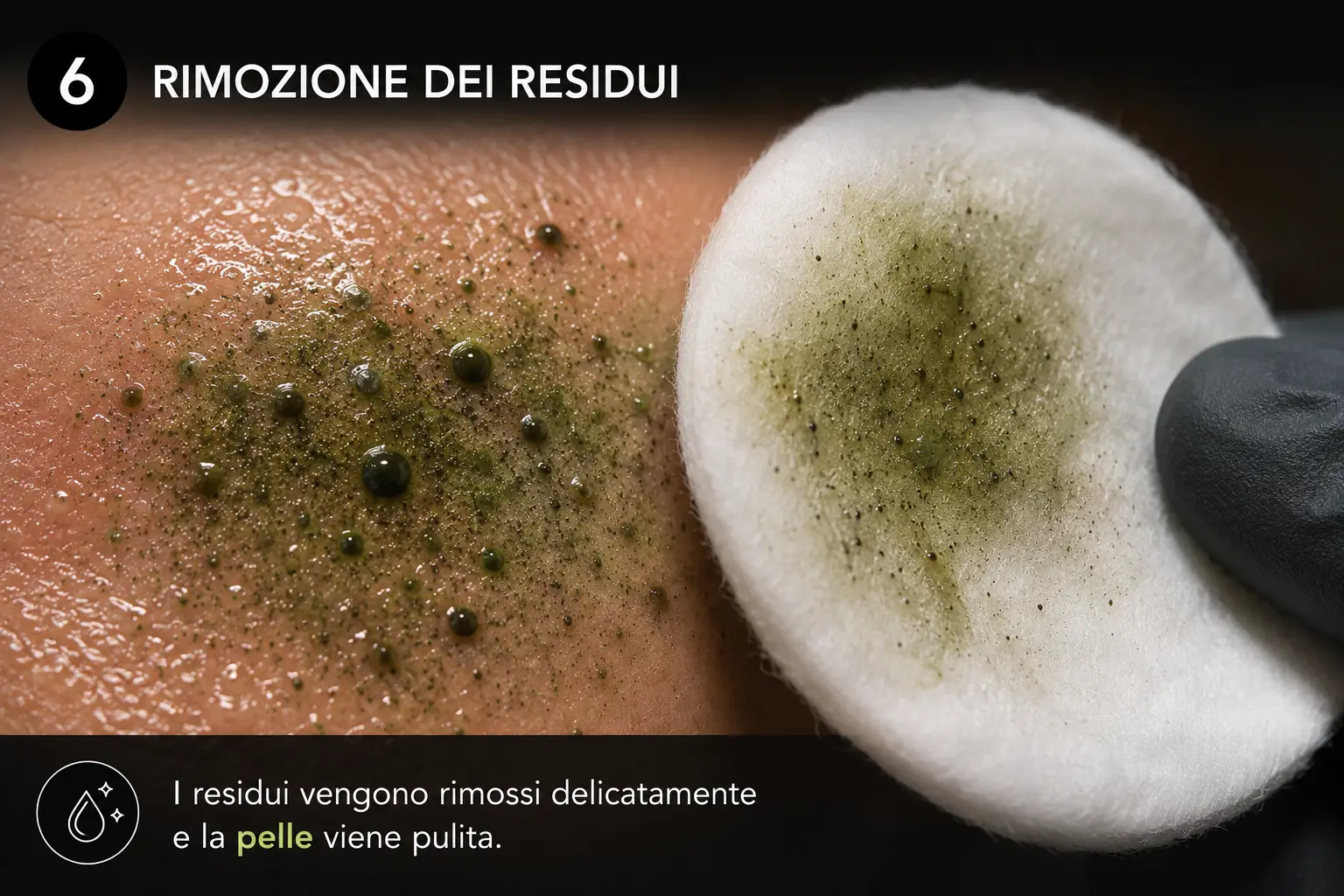 Espulsione