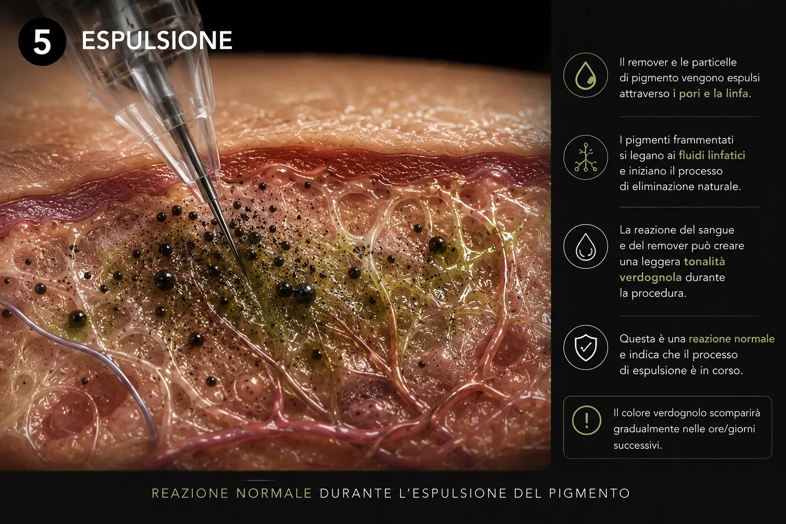 Rimozione dei residui